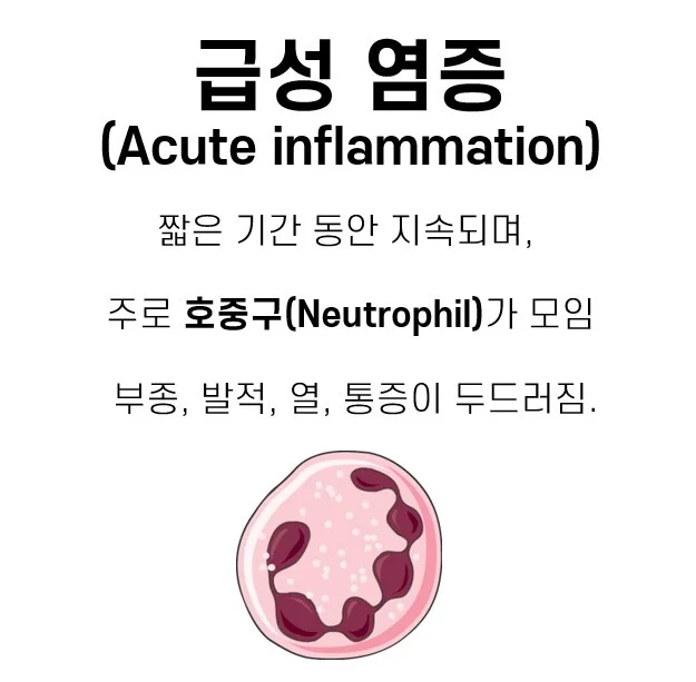 급성 염증