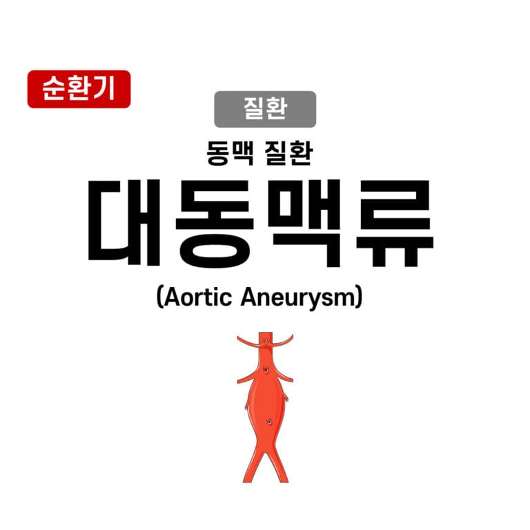대동맥류(Aortic Aneurysm)