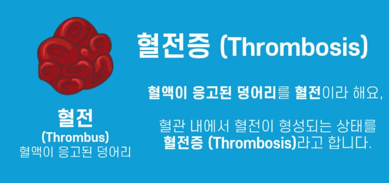 혈전증(Thrombosis)과 색전증(Embolism) - 의학당