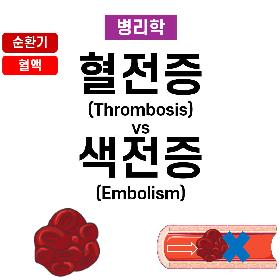 Thrombosis, Embolism