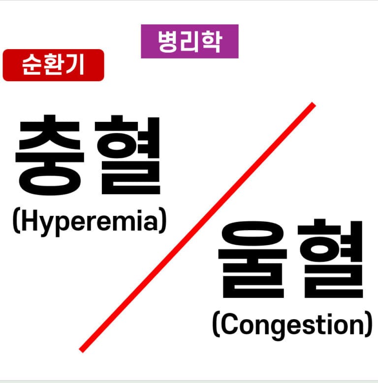 충혈(Hyperemia) & 울혈 (Congestion)
