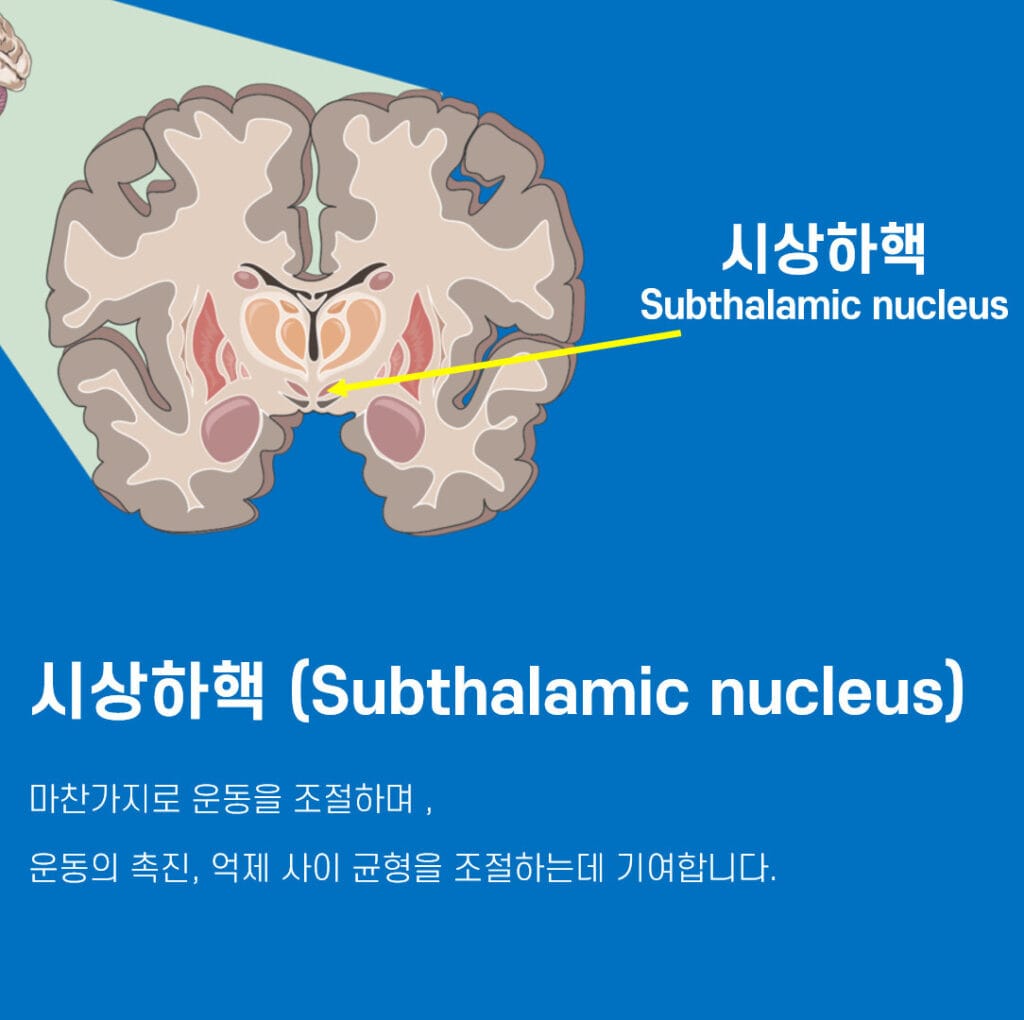 Basal Ganglia, Subthalamic nucleus