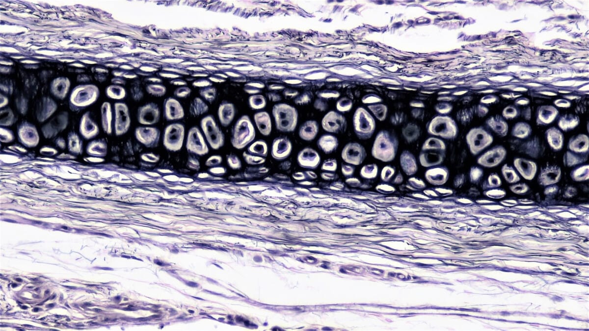 연골 (Cartilage) - 의학당