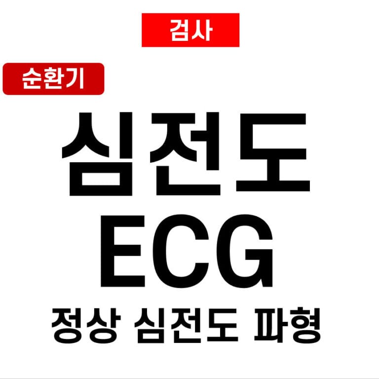 심전도(ECG)