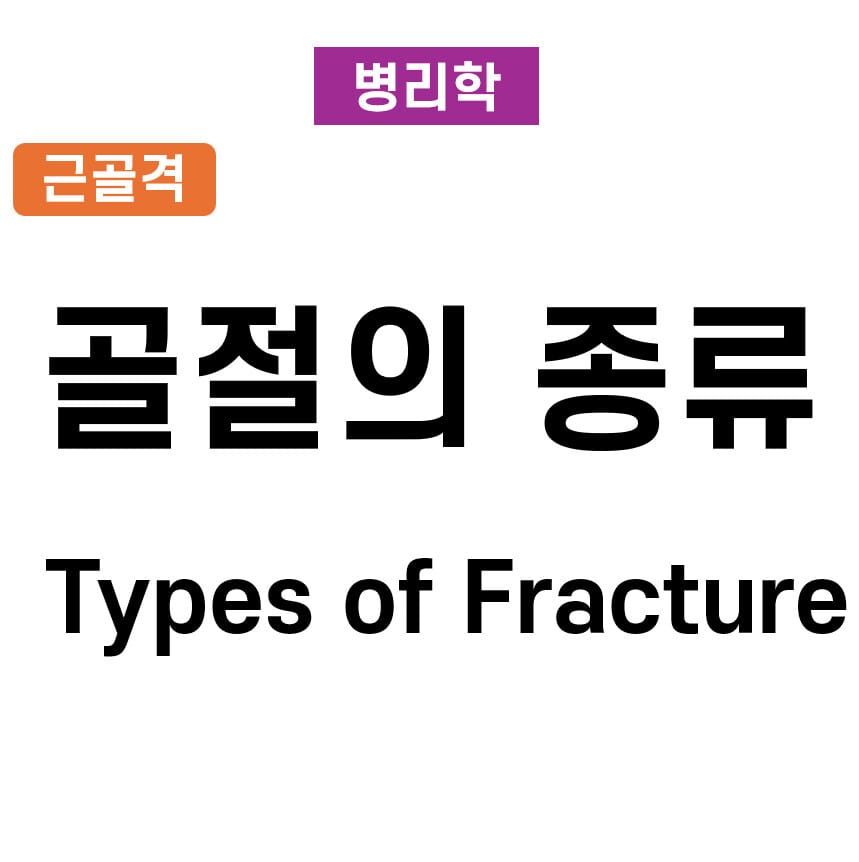 골절의 종류 (Types of Fractures)