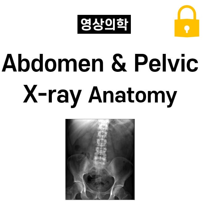 Abdomen & Pelvic X-ray Anatomy