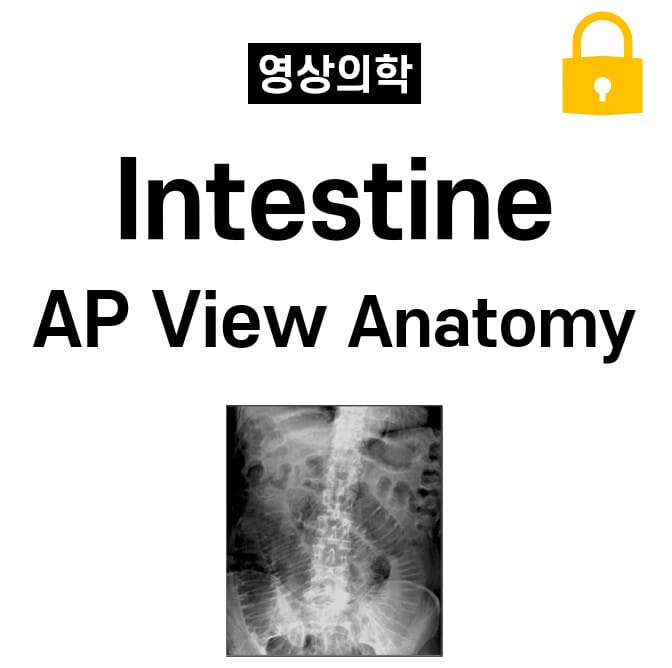 Intestine AP View Anatomy
