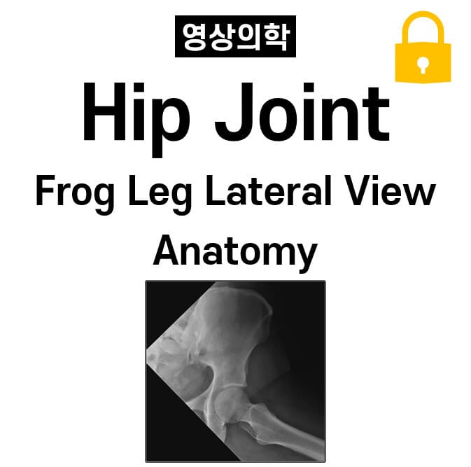 Hip Joint X-ray (Frog leg Lateral View) Anatomy