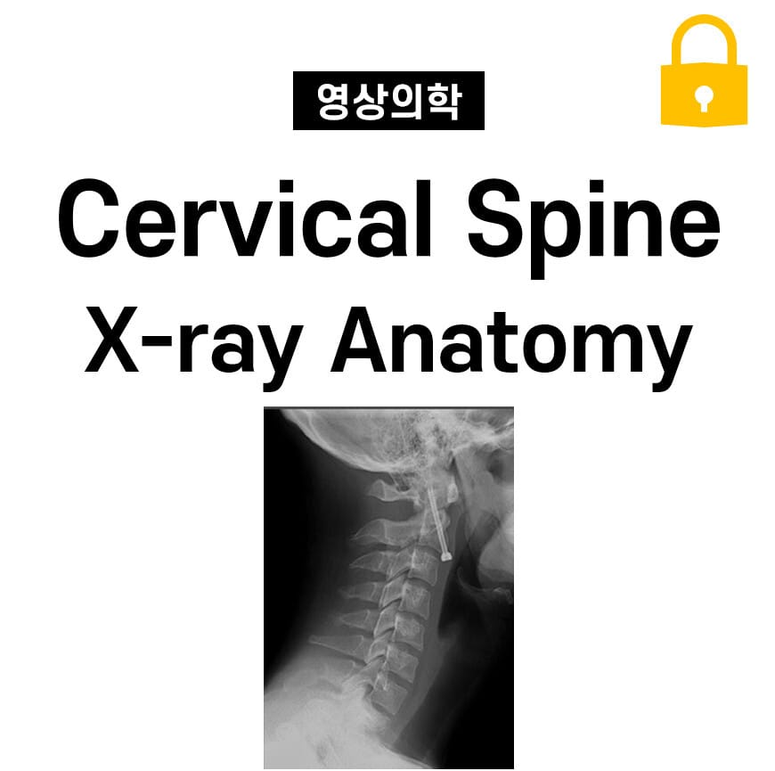 Cervical Spine X-ray Anatomy