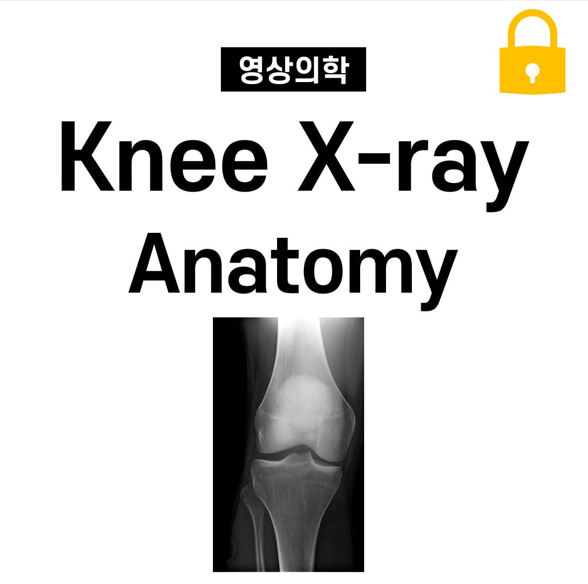 Knee X-ray Anatomy