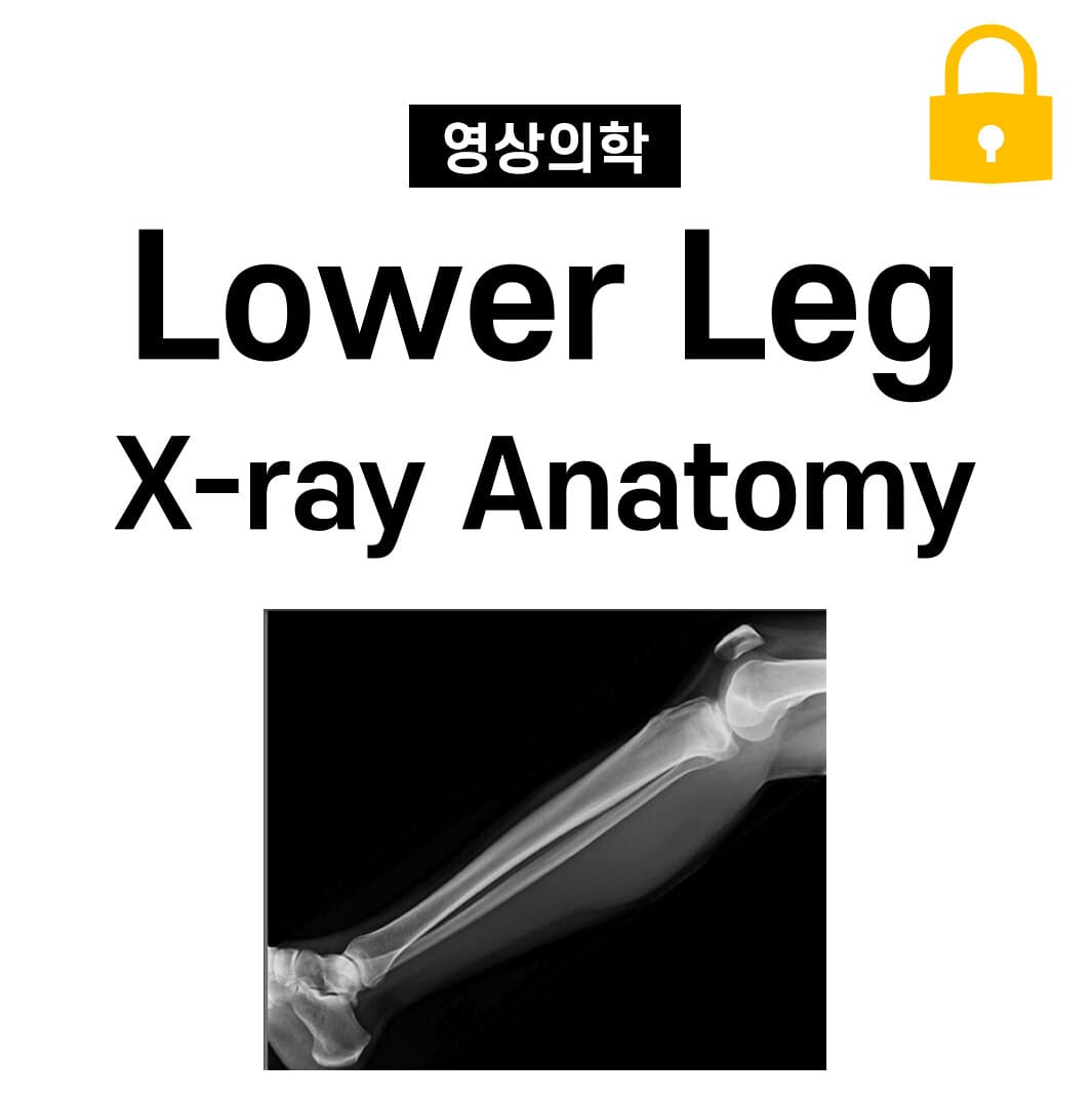 Lower Limb X-ray Anatomy