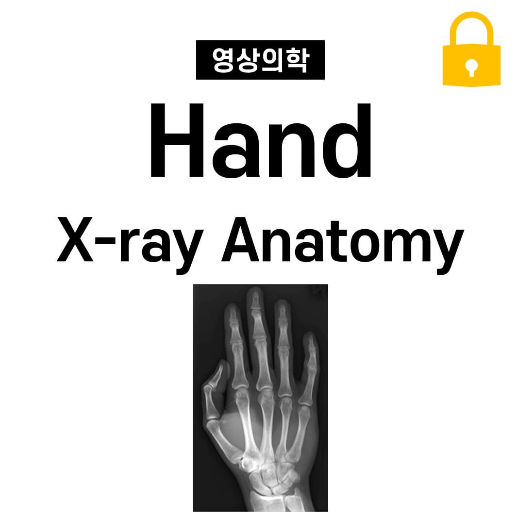 Hand X-ray Anatomy