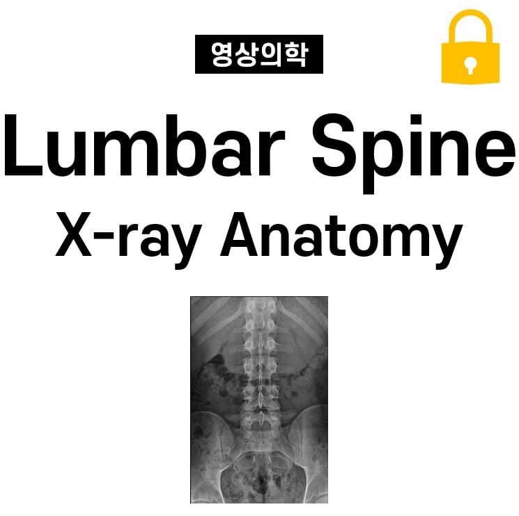Lumbar Spine X-ray Anatomy
