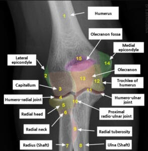 Elbow X-ray Anatomy - 의학당