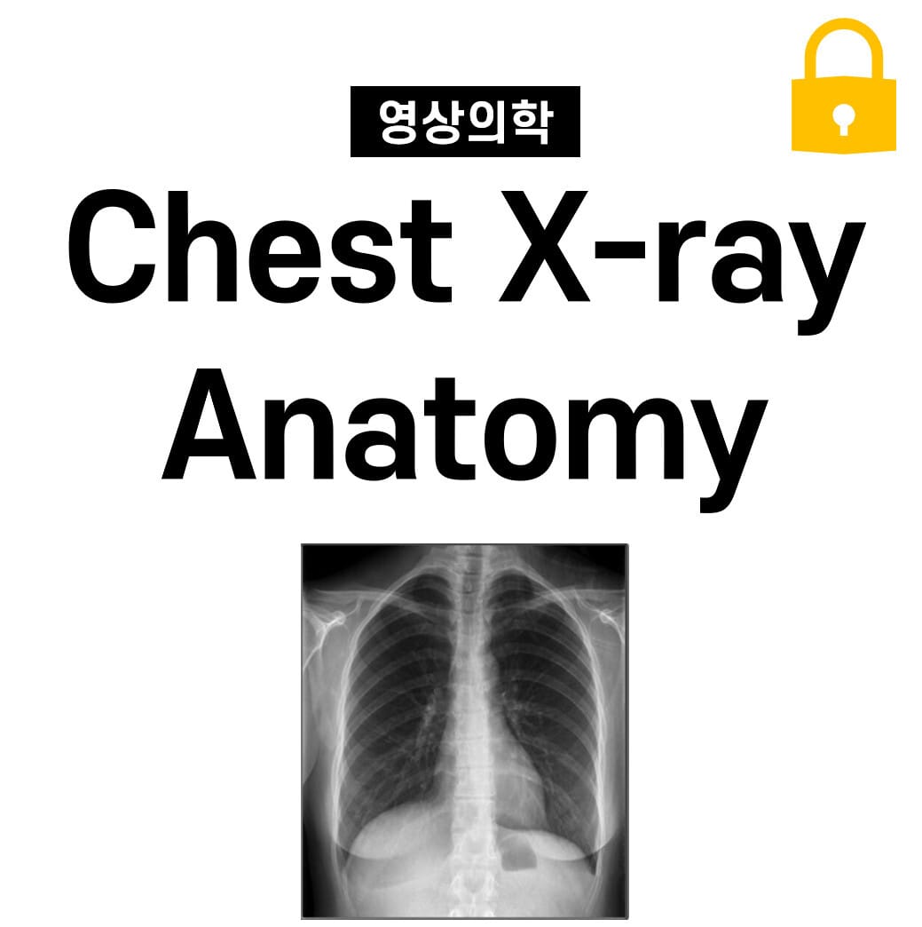 흉부 X-ray 해부학(Chest X-ray Anatomy)