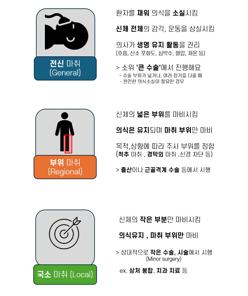 마취의 종류 (Types of Anesthesia)