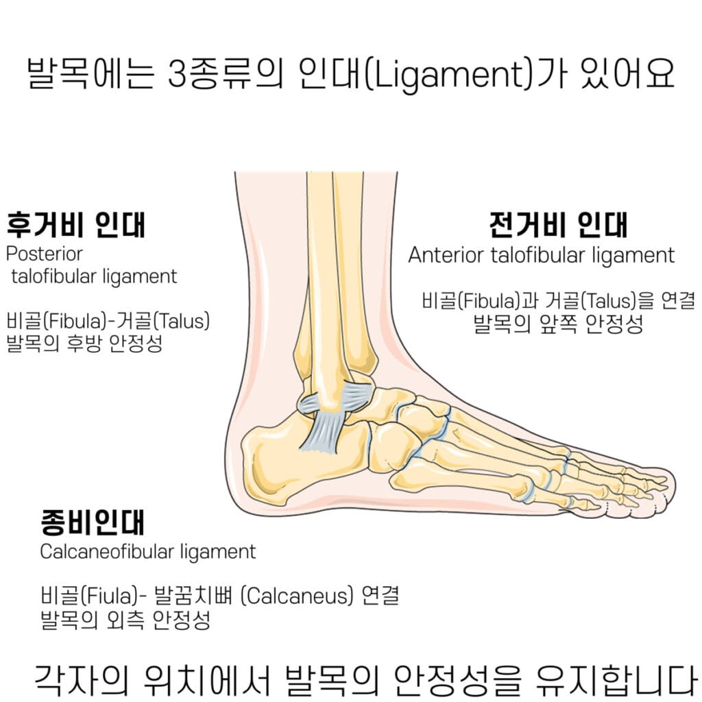 Sprain, 염좌, Ligaments