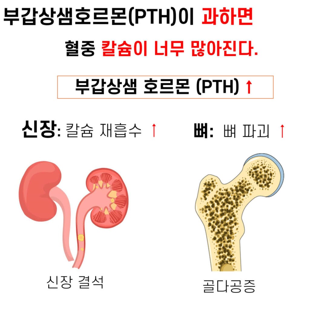 parathyroid hormone