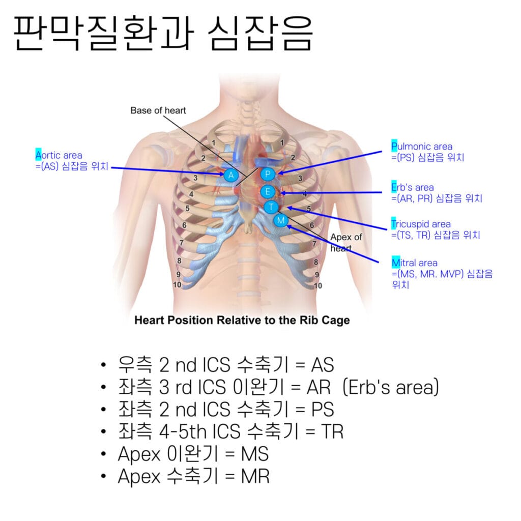 심장 판막 질환 (Heart Valve Disease) - 의학당