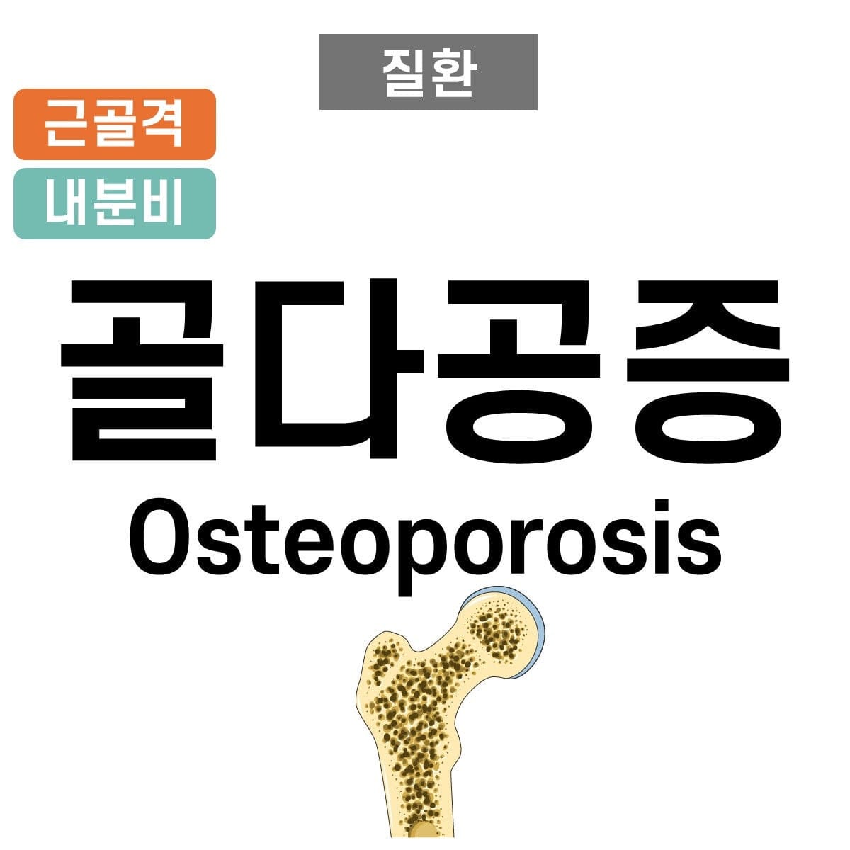 osteoporosis