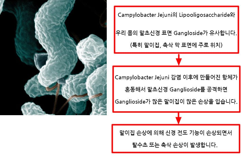 Guillain-Barré Syndrome