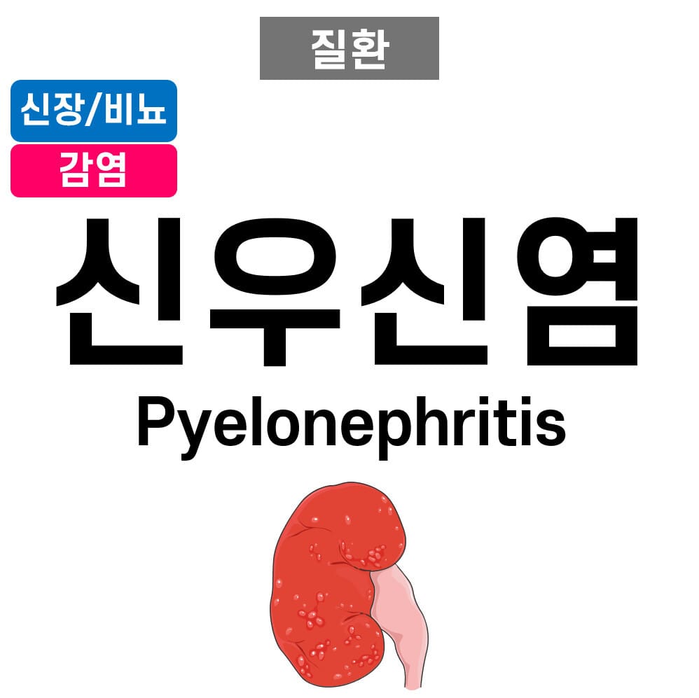 pyelonephritis