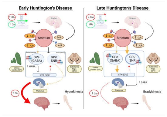 헌팅턴병 (Huntington’s Disease)