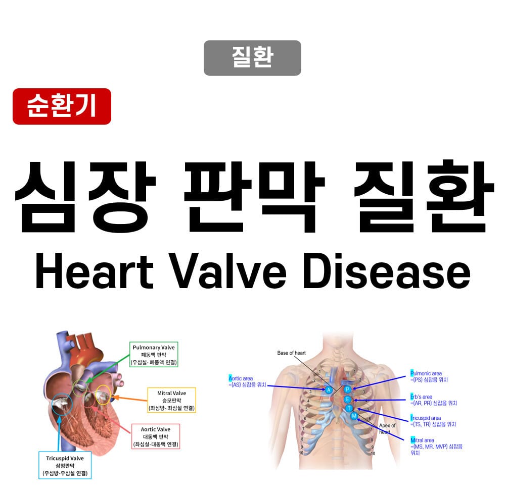 Heart Valve Disease
