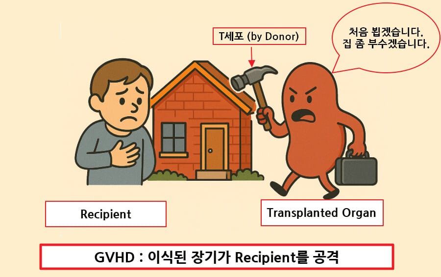 이식편 대 숙주 질환 (GVHD, Graft-versus-Host Disease)