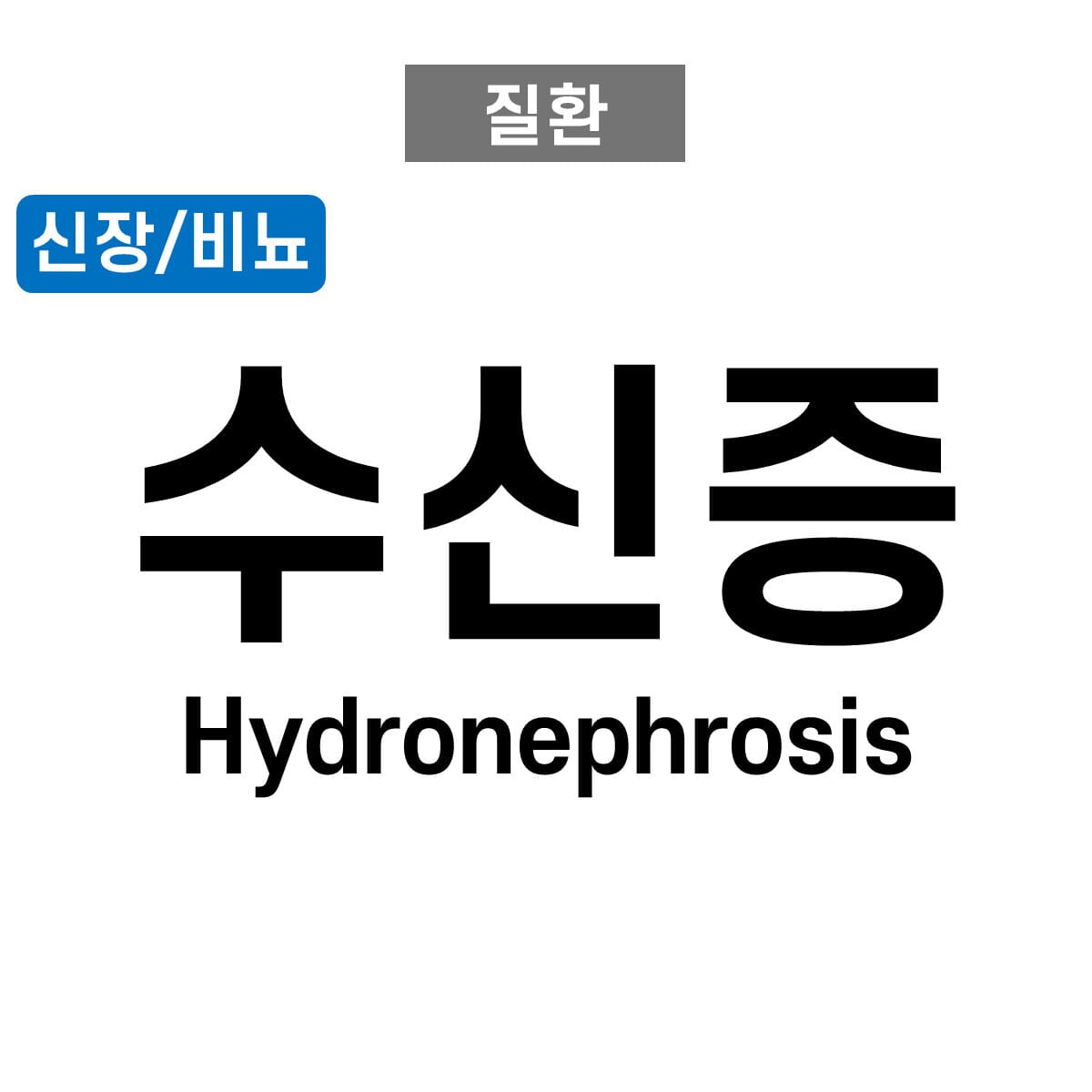 수신증 (Hydronephrosis)