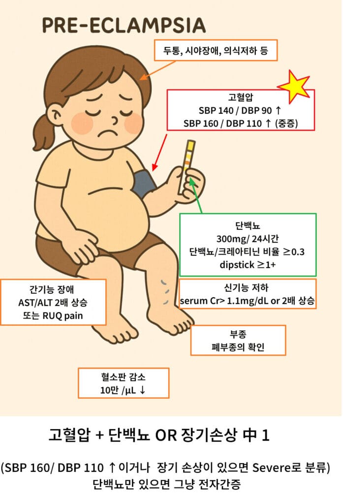 Pre-eclampsia
