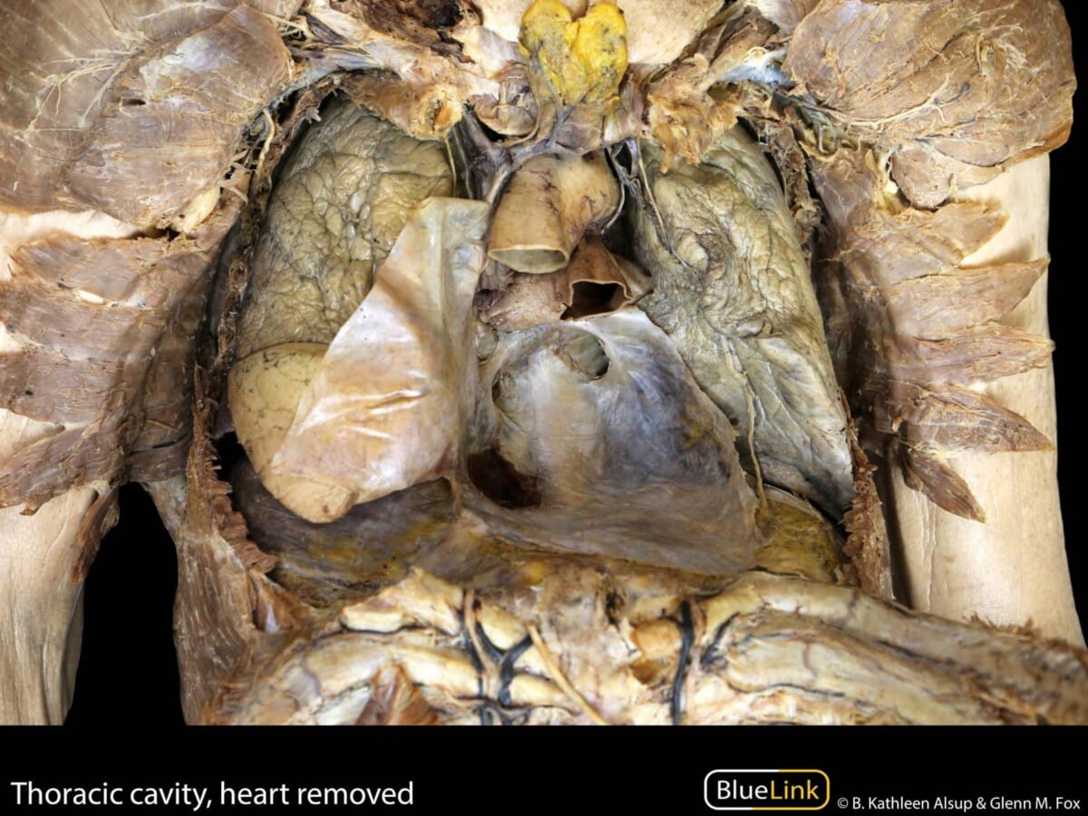 심장 해부학 (Heart Anatomy) - 의학당