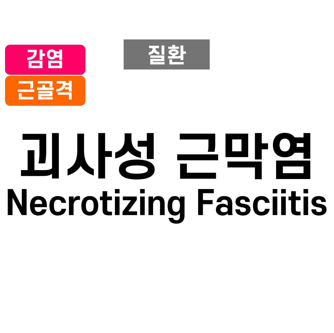 괴사성 근막염 (Necrotizing Fasciitis)