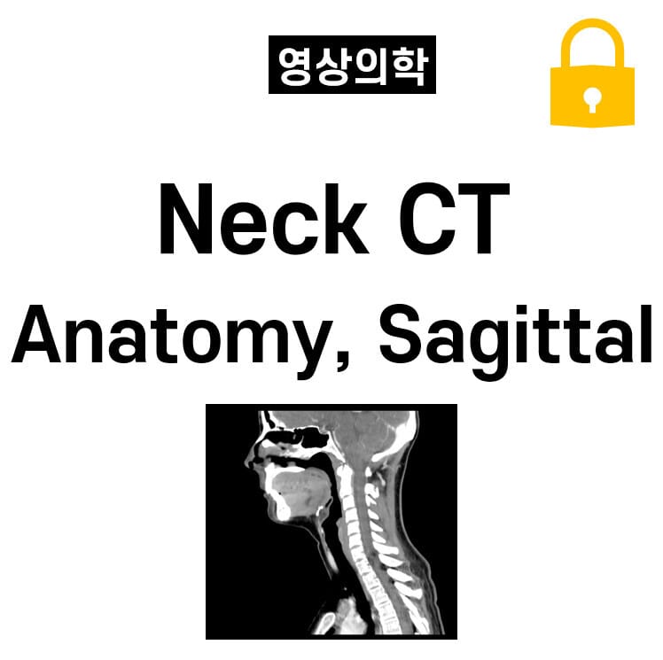 Neck CT Anatomy, Sagittal