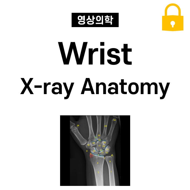 Wrist X-ray Anatomy
