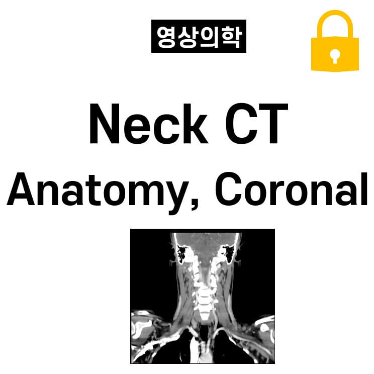 Neck CT Anatomy ,Coronal
