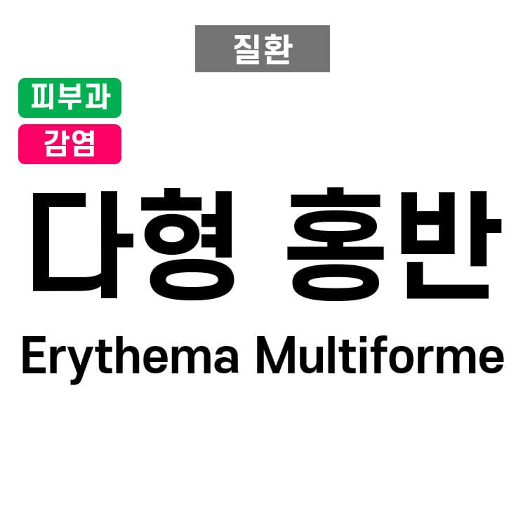 다형홍반 (Erythema Multiforme)