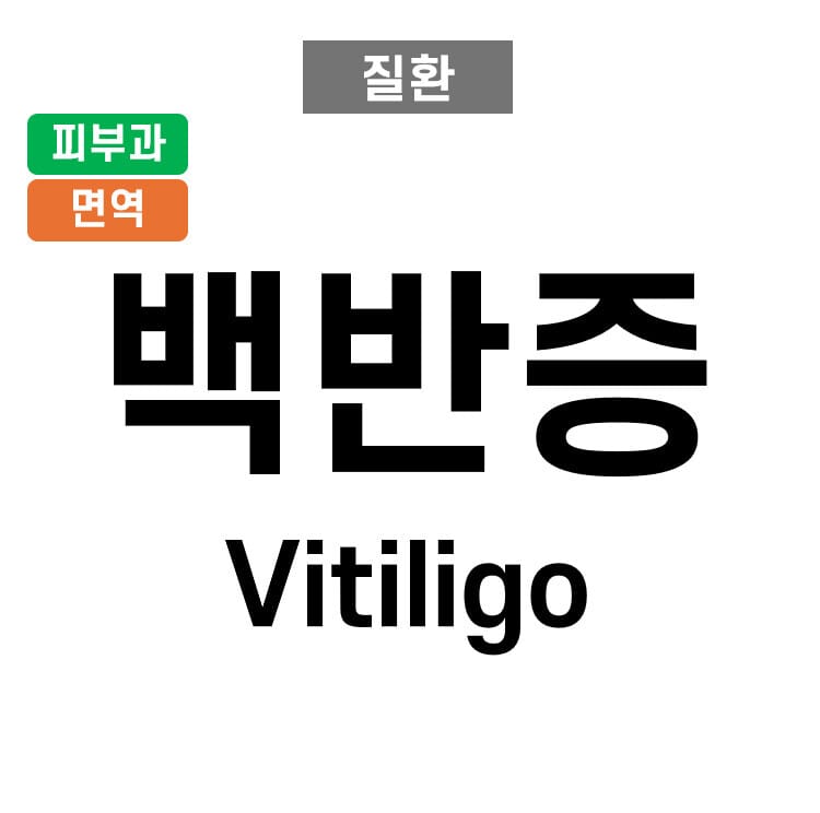 백반증 (Vitiligo)