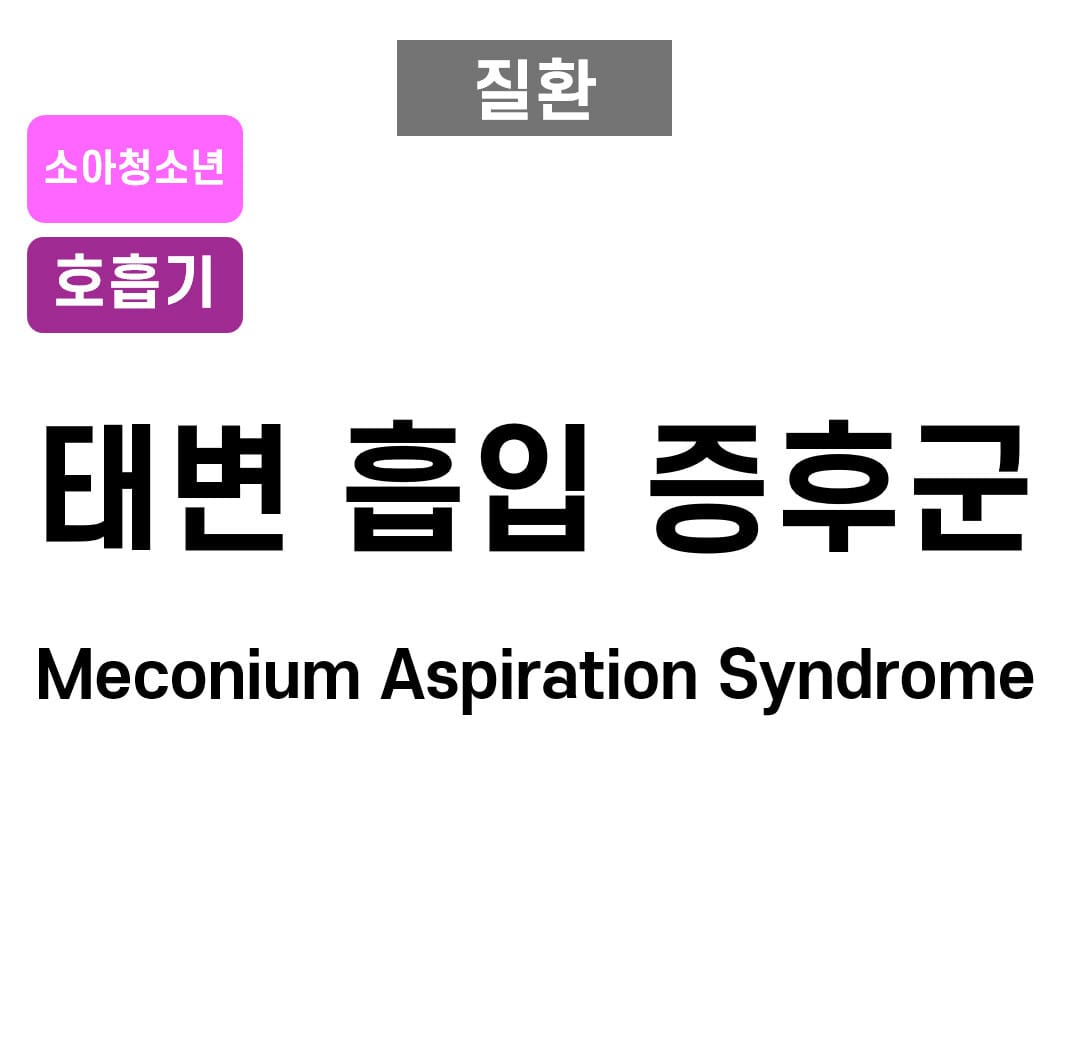 태변 흡입 증후군 (Meconium Aspiration Syndrome)