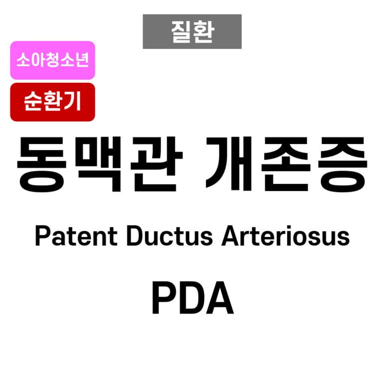 동맥관 개존증 (Patent Ductus Arteriosus , PDA)