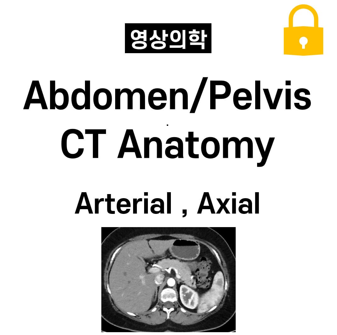 Abdomen/Pelvis CT Anatomy , Arterial Phase ,Axial