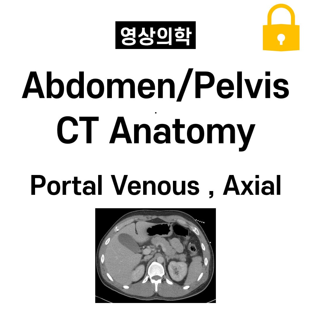 Abdomen/Pelvis CT Anatomy , Portal Venous Phase ,Axial