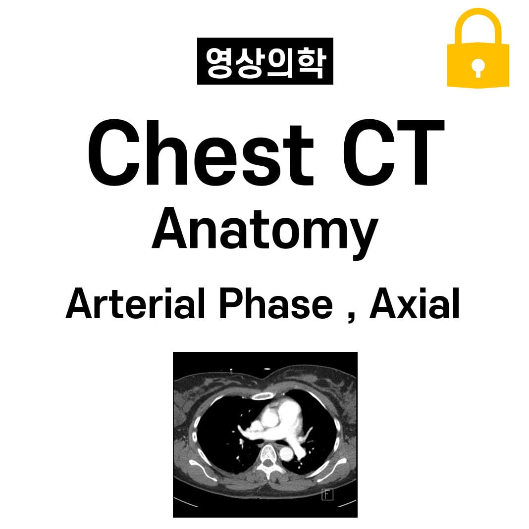 CT Chest Anatomy, Arterial phase ,  Axial