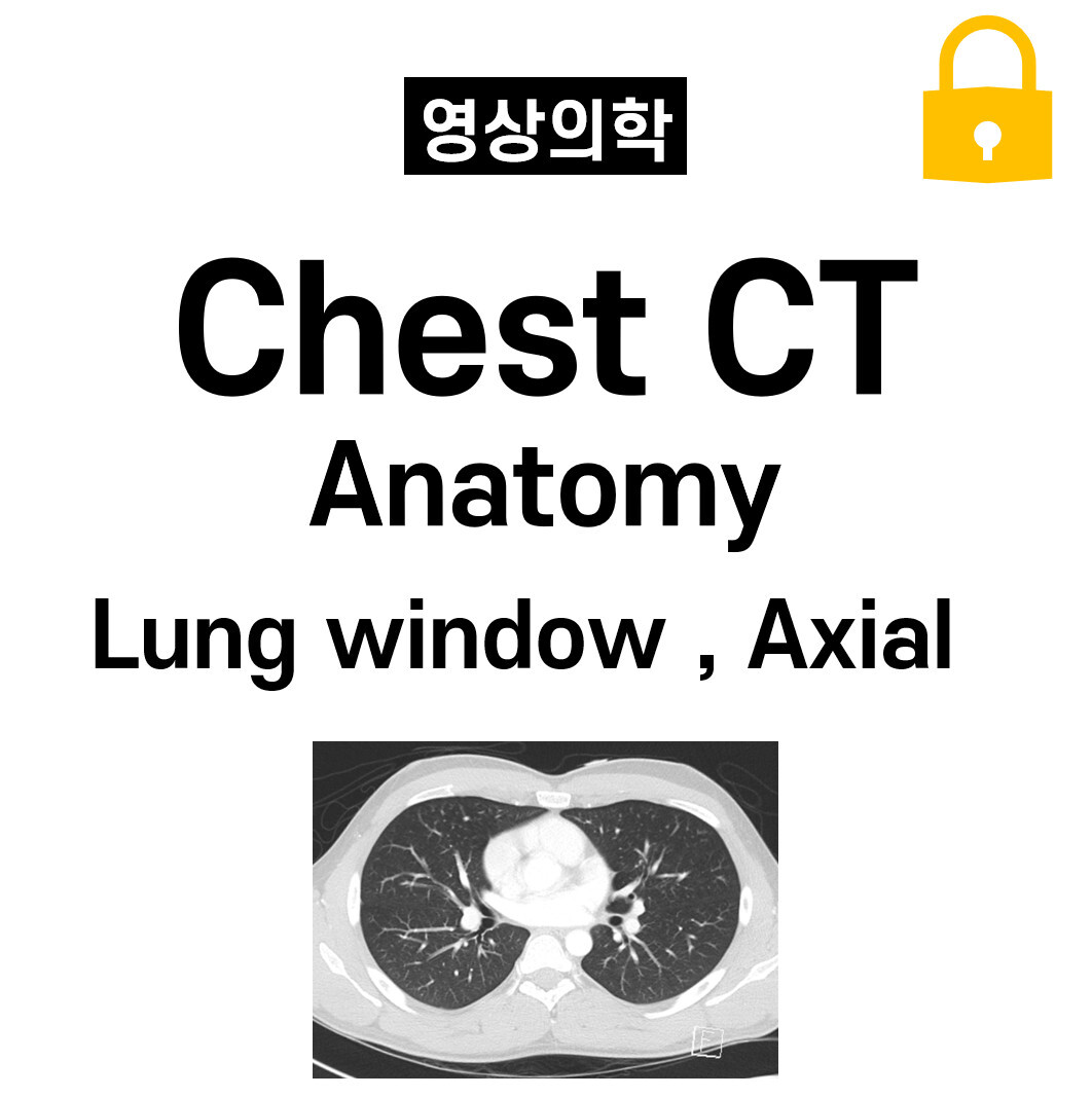 CT Chest Anatomy, Lung window, Axial
