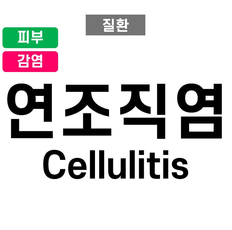 연조직염 (Cellulitis)