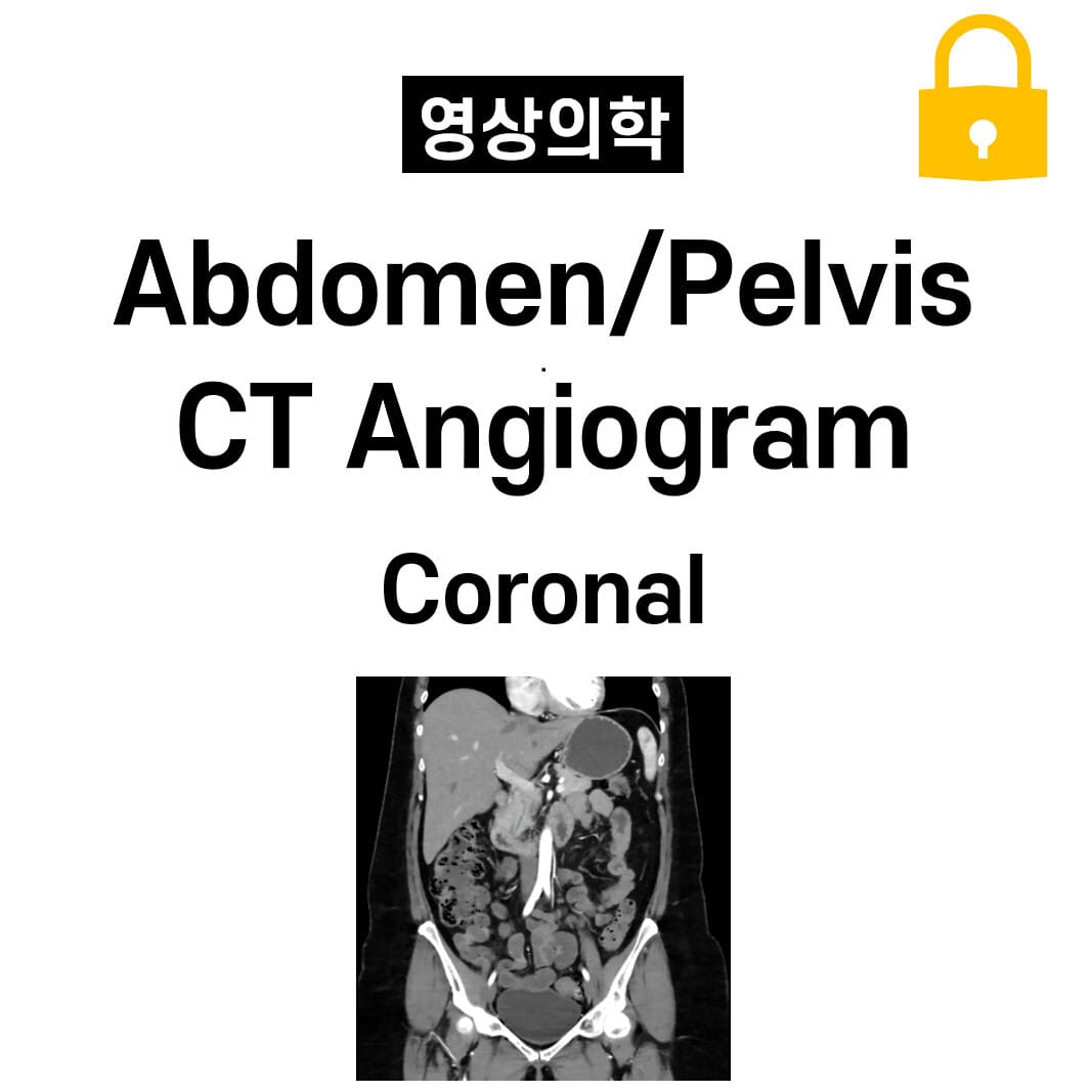 Abdomen/Pelvis CT Angiogram , Coronal