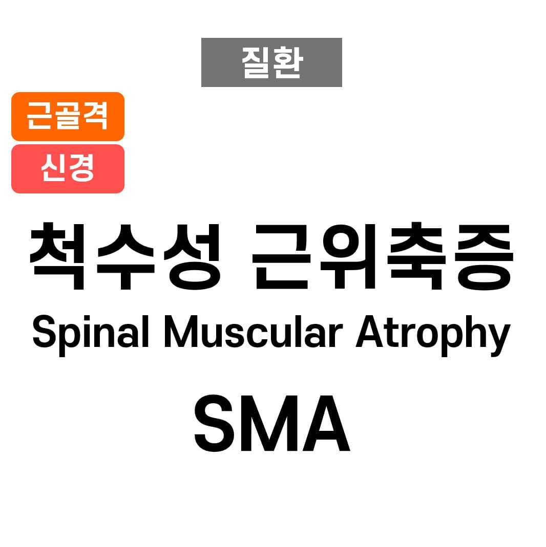척수성 근위축증 (Spinal Muscular Atrophy, SMA)