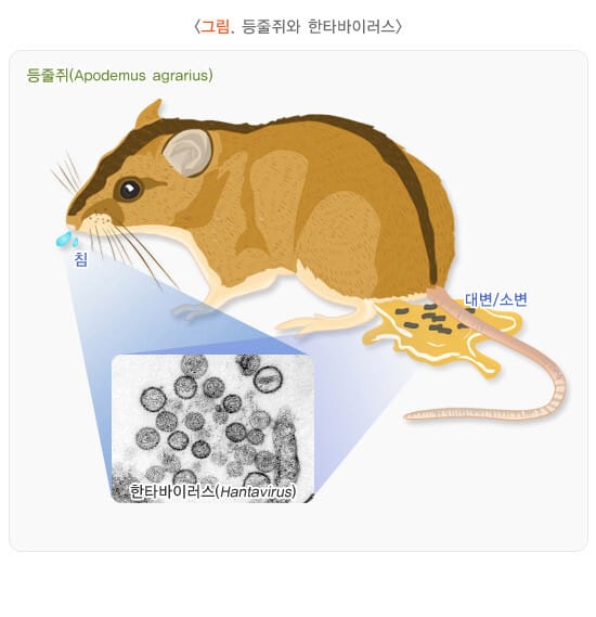 신증후군 출혈열 관련 이미지
