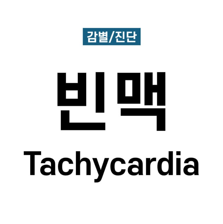 빈맥(Tachycardia)