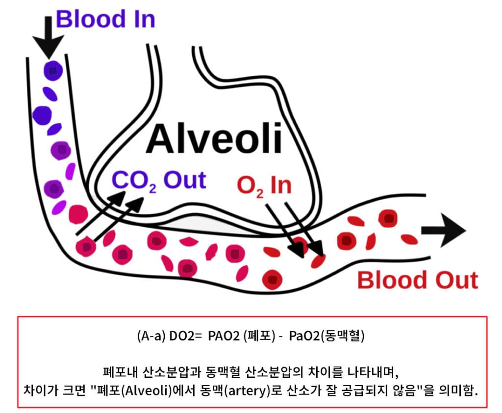 (A-a)DO2의 해석